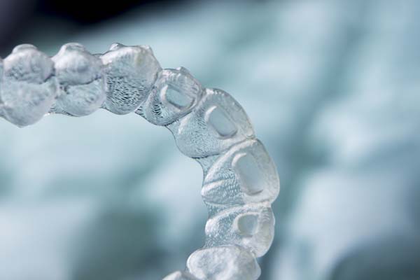 How To Decide If Clear Aligners Are The Right Orthodontic Treatment For You