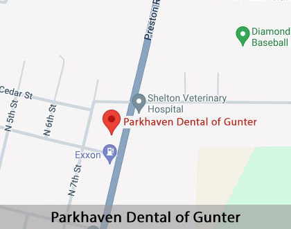 Map image for Dental Bonding in Gunter, TX